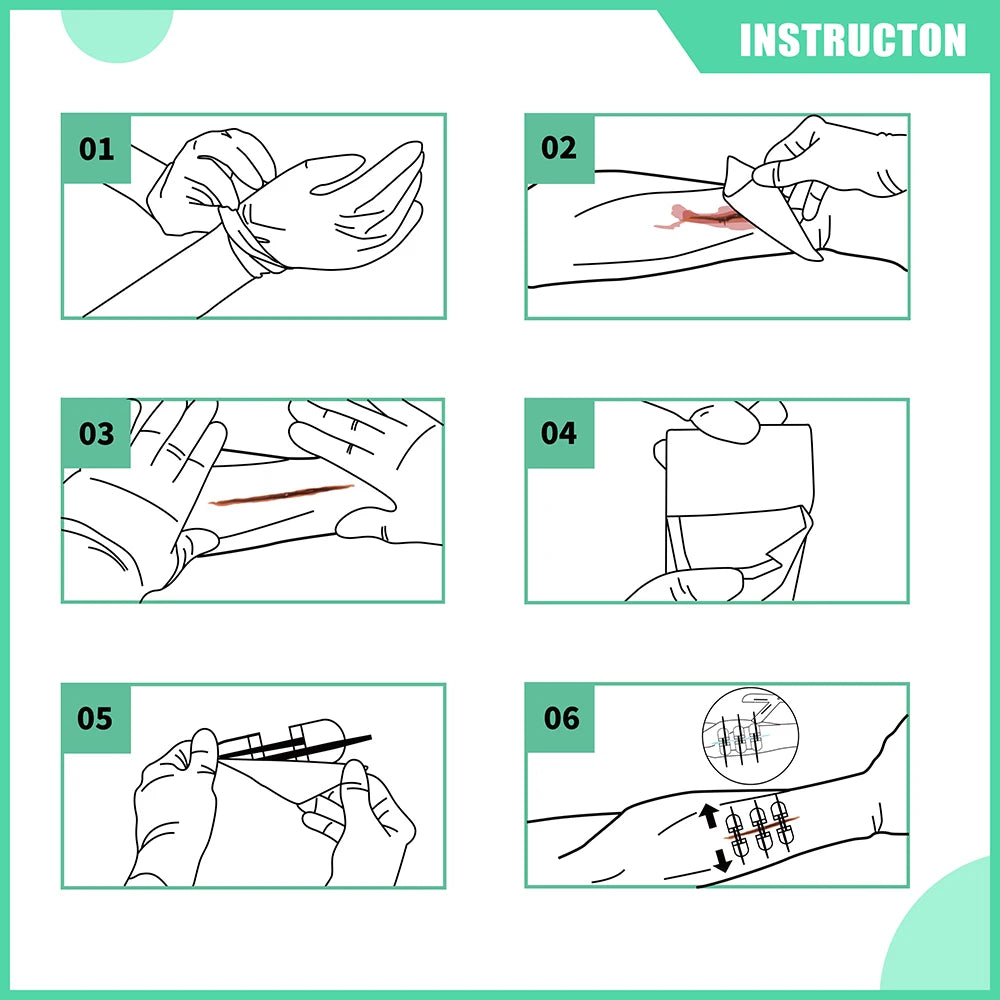 RHINO RESCUE Zip Stitch 6pcs Wound Closure Strips Kit - Senior Support Goods